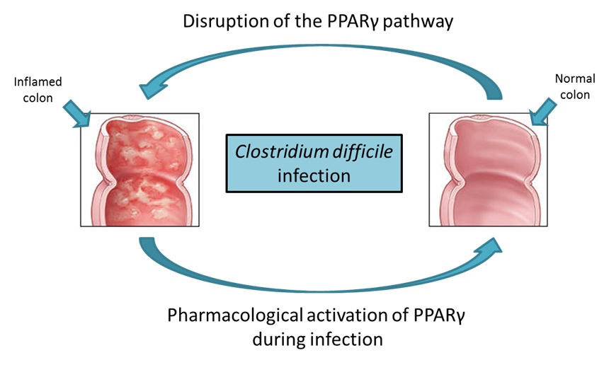 What causes a C. difficile infection?